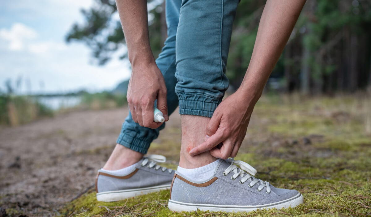 Vasara be įkandimų: 7 natūralios priemonės, kurios išgelbės tavo odą